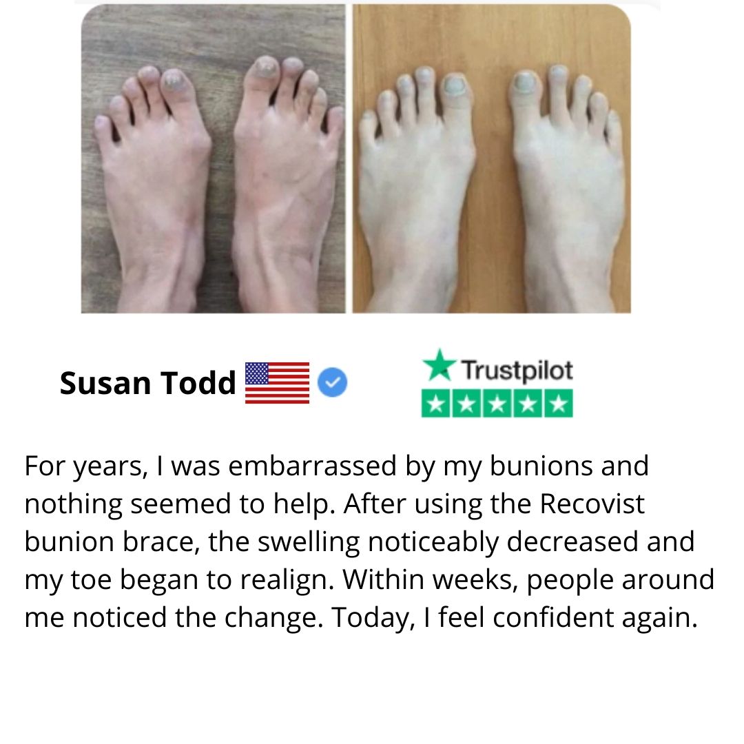 Everlixe™ | Gradually correct the position of your toes