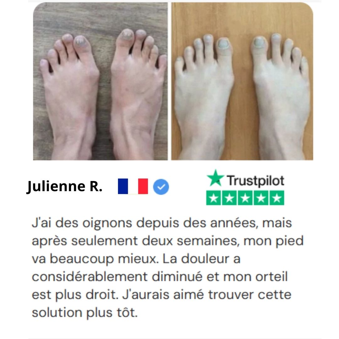 Everlixe™  | Corrigez progressivement la position des orteils
