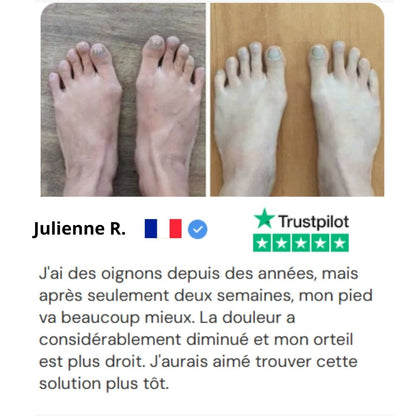 Everlixe™  | Corrigez progressivement la position des orteils