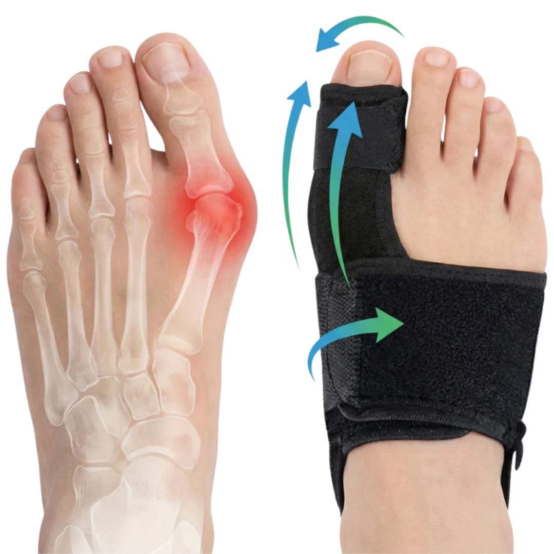 Everlixe™  | Corrigez progressivement la position des orteils