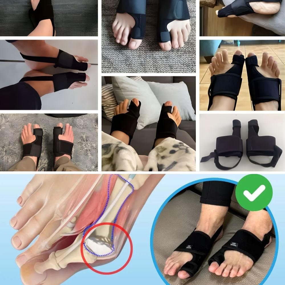 Everlixe™  | Corrigez progressivement la position des orteils