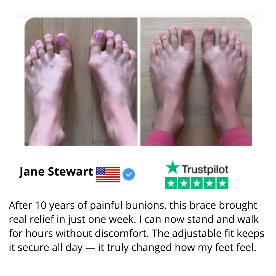 Everlixe™ | Gradually correct the position of your toes