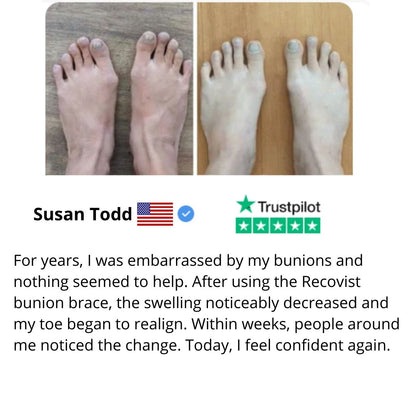 Everlixe™ | Gradually correct the position of your toes